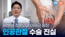 무릎 관절 수술, 무작정 늦추는 게 정답일까?🦵｜내 관절 살리는 절골술부터 최신 로봇 인공관절까지 [TBC클리닉건강365]