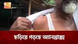 কুষ্টিয়ার দৌলতপুরে ছড়িয়ে পড়ছে অ্যানথ্রাক্স বা তড়কা রোগ | Mohona TV
